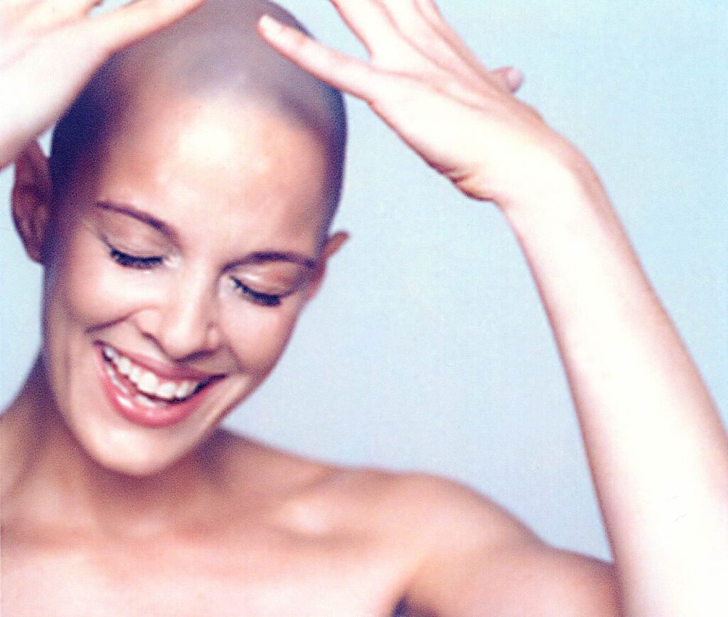 Bald Is Beautiful founder Sharon Blynn 