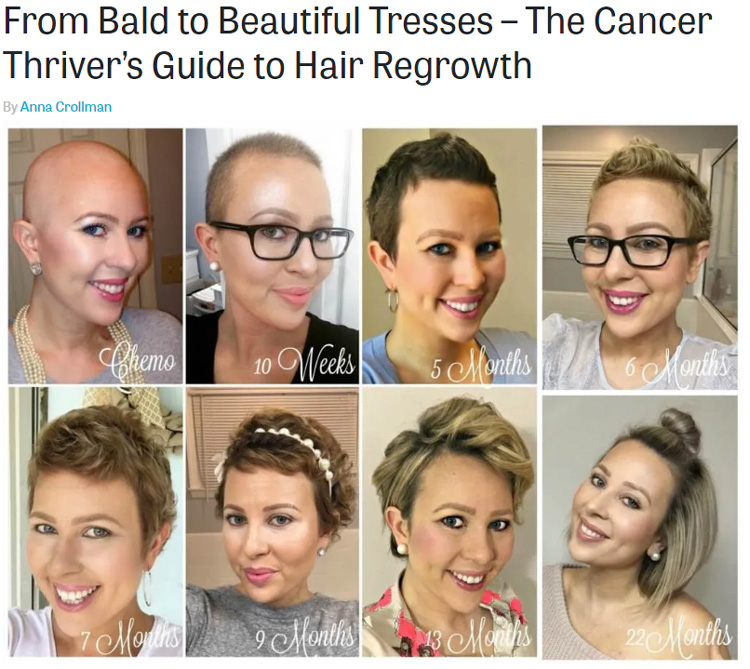 chemo hair loss regrowth picture scale