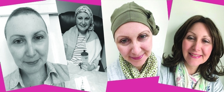 stages of hair loss due to chemotherapy