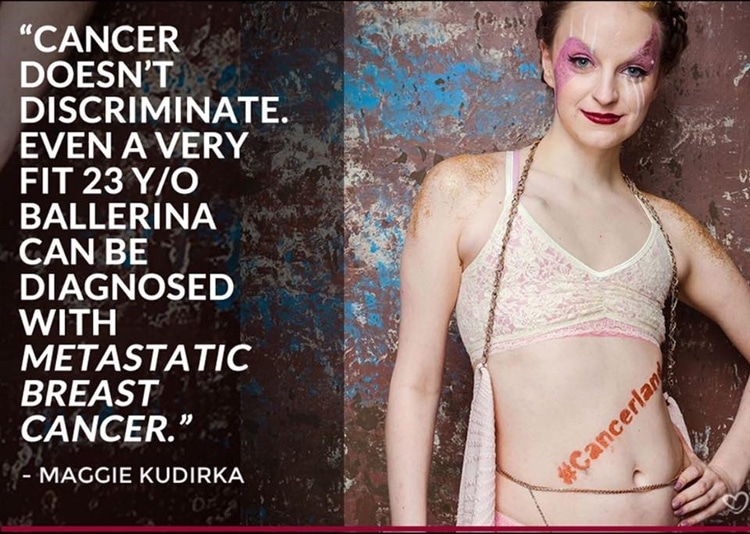 young woman dancer talks about her cancer treatment