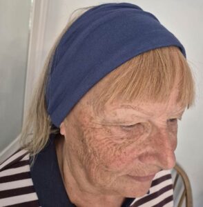 Blog on Frontal Fibrosing Alopecia: Headscarves, Turbans & Wide Headbands